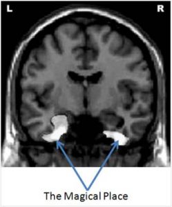 brain MRI